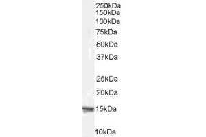 Image no. 1 for anti-Ribosomal Protein S19 (RPS19) (Internal Region) antibody (ABIN374632) (RPS19 Antikörper  (Internal Region))