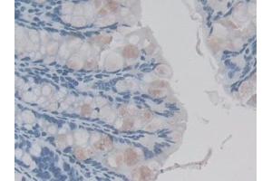 Detection of IL1F9 in Mouse Colon Tissue using Monoclonal Antibody to Interleukin 1 Family, Member 9 (IL1F9) (IL1F9 Antikörper  (AA 5-149))