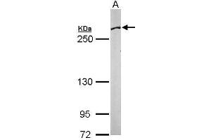 WB Image Sample (50 ug of whole cell lysate) A: Mouse brain 5% SDS PAGE antibody diluted at 1:1000