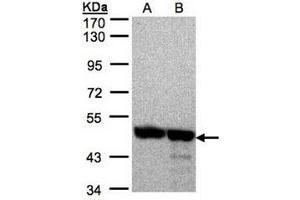 AP31121PU-N ANXA7 antibody staining of 293T (Lane A), A431 (B) whole cell lysates (30 µg) at 1/2000 dilution, 7. (Annexin VII Antikörper  (AA 122-419))