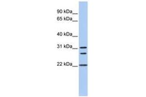 Image no. 1 for anti-Calponin (N-Term) antibody (ABIN6743468) (Calponin Antikörper  (N-Term))