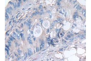 Immunohistochemistry (IHC) image for anti-Leukemia Inhibitory Factor (LIF) (AA 2-201) antibody (ABIN7430882)