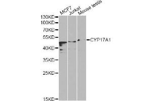 Western blot analysis of extracts of various cell lines, using CYP17A1 Antibody (ABIN5970640) at 1/1000 dilution. (CYP17A1 Antikörper)