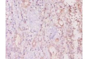 Immunohistochemistry of paraffin-embedded human kidney tissue using ABIN7160281 at dilution of 1:20 (MUC16 Antikörper  (AA 14067-14328))