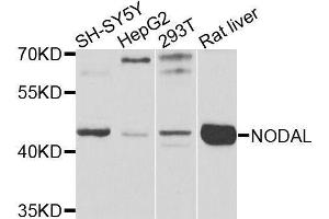 Western blot analysis of extracts of various cell lines, using NODAL antibody (ABIN6003633) at 1/1000 dilution. (Nodal Antikörper)