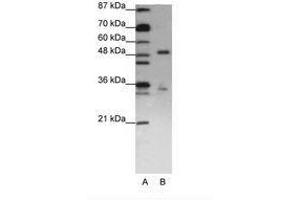 Image no. 2 for anti-UPF3 Regulator of Nonsense Transcripts Homolog B (UPF3B) (N-Term) antibody (ABIN203166) (UPF3B Antikörper  (N-Term))