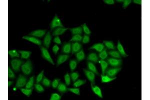 Immunofluorescence analysis of A549 cells using IRF8 antibody.