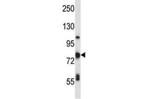 TP63 antibody western blot analysis in MDA-MB231 lysate. (p63 Antikörper  (AA 651-680))