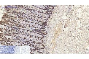 Immunohistochemistry of paraffin-embedded Human colon tissue using CK-8 Monoclonal Antibody at dilution of 1:200. (KRT8 Antikörper)