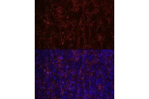 Immunofluorescence analysis of human spleen using CD23 Rabbit mAb (ABIN7267160) at dilution of 1:100 (40x lens). (FCER2 Antikörper)