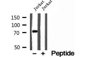 Western blot analysis of extracts of Jurkat cells, using MTO1 antibody. (MTO1 Antikörper  (N-Term))