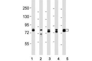 Western blot testing of DNM1L antibody at 1:8000 dilution and lysate from: 1: rat PC12 (Dynamin 1-Like Antikörper  (C-Term))