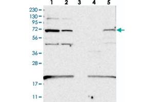Western blot analysis of Lane 1: RT-4, Lane 2: U-251 MG, Lane 3: Human Plasma, Lane 4: Liver, Lane 5: Tonsil with EEFSEC polyclonal antibody  at 1:250-1:500 dilution. (EEFSEC Antikörper)