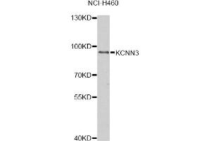 Western blot analysis of extracts of NCI-H460 cells, using KCNN3 antibody.