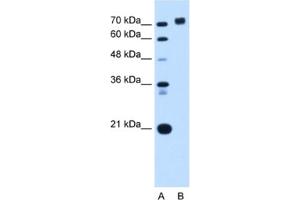 Western Blotting (WB) image for anti-Protein Tyrosine Phosphatase, Receptor Type, N (PTPRN) antibody (ABIN2462847) (PTPRN Antikörper)