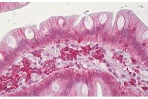 Anti-CLDN3 / Claudin 3 antibody IHC staining of human small intestine. (Claudin 3 Antikörper  (AA 171-220))