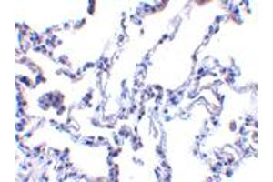 Immunohistochemistry of RRM2B in human lung tissue with RRM2B polyclonal antibody  at 1 ug/mL . (RRM2B Antikörper  (AA 2-17))