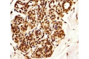Immunohistochemical analysis of paraffin-embedded human breast using PIN1 antibody at 1:25 dilution. (PIN1 Antikörper)