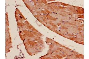 Immunohistochemistry of paraffin-embedded human skeletal muscle tissue using ABIN7143128 at dilution of 1:100 (Actin Antikörper  (AA 3-377))