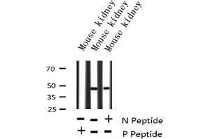 Western blot analysis of Phospho-IL-8R beta/CDw128 beta (Ser347) expression in Mouse kidney lysate (CXCR2 Antikörper  (pSer347))