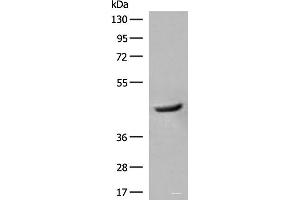 Western blot analysis of Human fetal liver tissue lysate using GCAT Polyclonal Antibody at dilution of 1:400 (GCAT Antikörper)