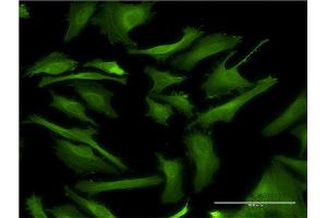 Immunofluorescence of monoclonal antibody to DAPK2 on HeLa cell. (DAPK2 Antikörper  (AA 281-370))