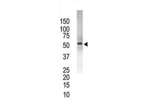 Western Blotting (WB) image for anti-Ubiquitin Specific Peptidase 14 (USP14) antibody (ABIN3001476)