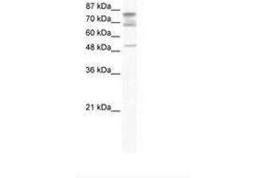 Image no. 1 for anti-DEAD (Asp-Glu-Ala-Asp) Box Polypeptide 46 (DDX46) (C-Term) antibody (ABIN202967)