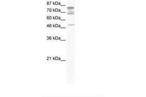 DDX46 anticorps  (C-Term)