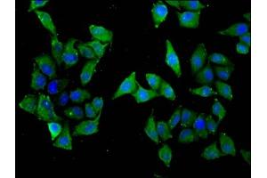 Immunofluorescence staining of Hela cells with ABIN7170160 at 1:33, counter-stained with DAPI. (SLC22A5 Antikörper  (AA 42-142))
