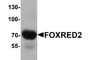 Western blot analysis of FOXRED2 in human lung tissue lysate with FOXRED2 antibody at 1 µg/mL. (FOXRED2 Antikörper  (N-Term))
