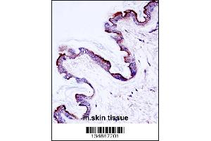 Mouse Prkch Antibody immunohistochemistry analysis in formalin fixed and paraffin embedded mouse skin tissue followed by peroxidase conjugation of the secondary antibody and DAB staining.