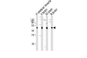 Western blot analysis of lysates from human skeletal muscle, human brain, mouse brain, rat brain tissue (from left to right), using PDK2 Antibody (ABIN659060 and ABIN2838063). (PDK2 Antikörper)