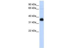 Image no. 1 for anti-Aryl Hydrocarbon Receptor Interacting Protein (AIP) (AA 36-85) antibody (ABIN6744248) (AIP Antikörper  (AA 36-85))