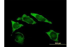 Immunofluorescence of purified MaxPab antibody to IMP-2 on HeLa cell.