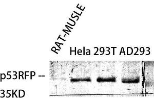 Western Blot (WB) analysis of specific cells using p53RFP Polyclonal Antibody. (RNF144B Antikörper  (Internal Region))
