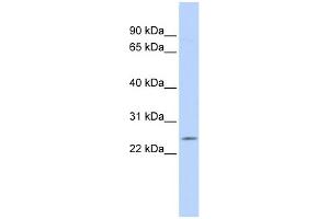Western Blotting (WB) image for anti-Proteasome (Prosome, Macropain) Subunit, beta Type, 5 (PSMB5) (Middle Region) antibody (ABIN2786720)
