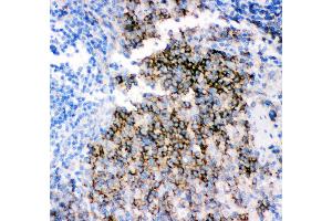 Anti- CD79B picoband antibody,IHC(P) IHC(P): Rat Spleen Tissue (CD79b Antikörper  (AA 29-229))