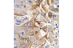 Image no. 2 for anti-Cytochrome P450, Family 2, Subfamily W, Polypeptide 1 (CYP2W1) (N-Term) antibody (ABIN360102)