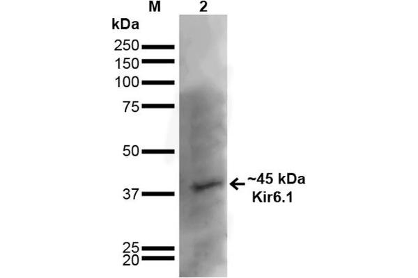 KCNJ8 Antikörper  (AA 306-424) (HRP)