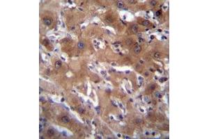 Formalin fixed, paraffin embedded human liver tissue stained with RASSF10 Antibody  followed by peroxidase conjugation of the secondary antibody and DAB staining. (RASSF10 Antikörper  (Middle Region))