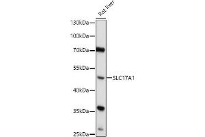 Western blot analysis of extracts of Rat liver, using SLC17 antibody (6642) at 1:1000 dilution. (SLC17A1 Antikörper  (AA 1-100))