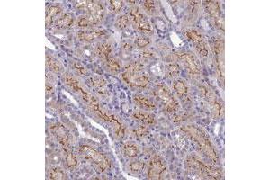 Immunohistochemical staining of human kidney with ANKS4B polyclonal antibody  shows strong membranous positivity in cells in tubules. (ANKS4B Antikörper)