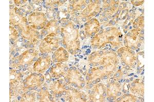 ABIN6258079 and ABIN6274660 at 1/100 staining Rat kidney tissue by IHC-P.