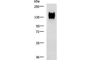 Western blot analysis of A549 cell lysate using CEACAM1 Polyclonal Antibody at dilution of 1:500 (CEACAM1 Antikörper)