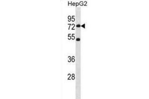 Western Blotting (WB) image for anti-SET Domain Containing 3 (SETD3) antibody (ABIN3001114) (SETD3 Antikörper)