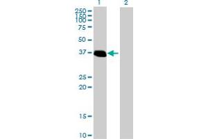 Western Blot analysis of ZNF444 expression in transfected 293T cell line by ZNF444 MaxPab polyclonal antibody. (ZNF444 Antikörper  (AA 1-326))
