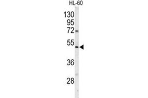 Western Blotting (WB) image for anti-Polymerase (DNA Directed), gamma 2, Accessory Subunit (POLG2) antibody (ABIN3001661) (POLG2 Antikörper)