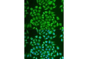 Immunofluorescence analysis of U2OS cells using PIP antibody (ABIN5973796). (PIP Antikörper)