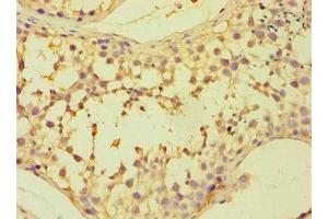 Immunohistochemistry of paraffin-embedded human testis tissue using ABIN7152381 at dilution of 1:100 (CAPZB Antikörper  (AA 1-272))
